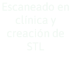 Escaneado en clínica y creación de STL